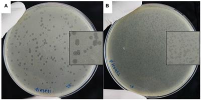 Induced Burkholderia prophages detected from the hemoculture: a biomarker for Burkholderia pseudomallei infection